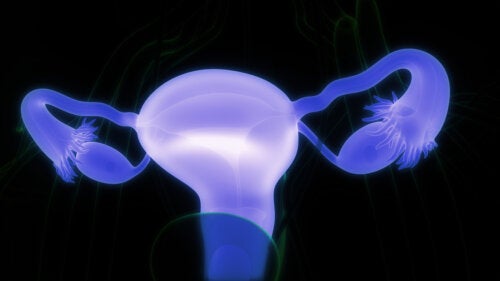 Cistos dermoides ovarianos: sintomas e quando consultar um médico