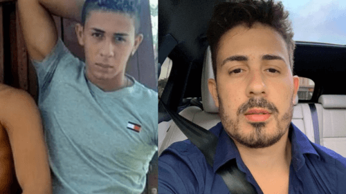 3 Famosos Que Se Arrependeram Da Harmonização Facial 7 harmonização facial