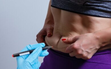 BodyTite, tecnologia para reduzir a flacidez corporal