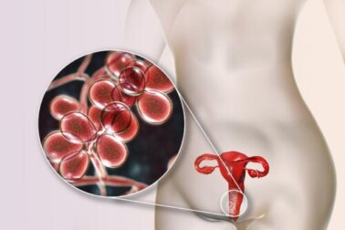 Corrimento vaginal amarelo com e sem odor: 5 causas e tratamento