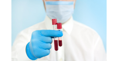 Diagnóstico preciso: Exame de sangue pode ajudar no tratamento e identificação da ansiedade