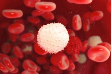 Macroglobulinemia de Waldenström: o que é?