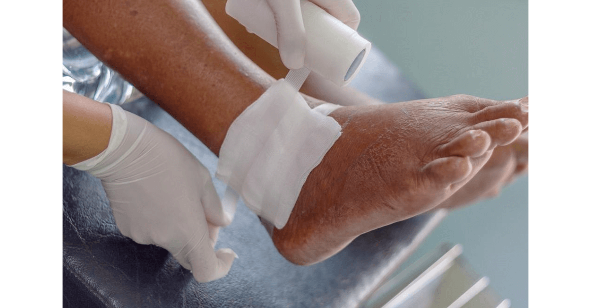 curativos à base de placenta