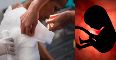 Possível novo e importante tratamento no Brasil: pesquisadores brasileiros testam curativos à base de placenta