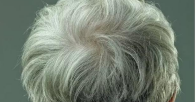 Cabelo branco é reversível, descobrem cientistas dos Estados Unidos
