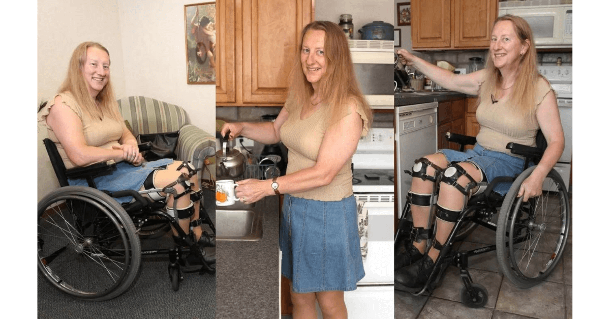 Mulher com transtorno de identidade de integridade corporal tenta se amputar e deseja ser paraplégica