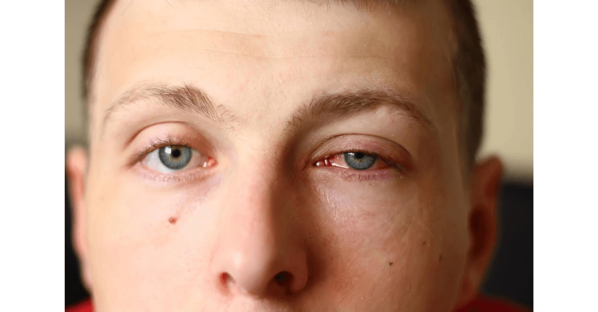 Dia Mundial da Higiene das Mãos: conheça 10 doenças que você pode evitar com a lavagem correta