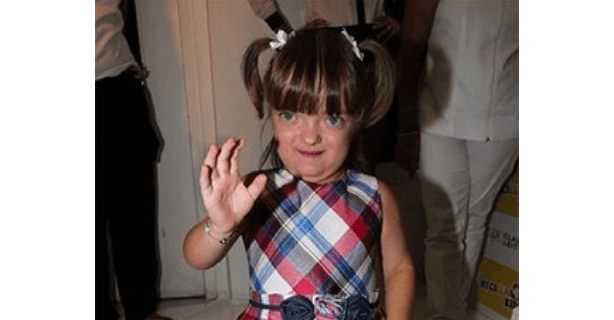 Filha de Justus e Ticiane conta como lida com críticas nas redes sociais devido à estenose craniofacial: “Eu me amo”