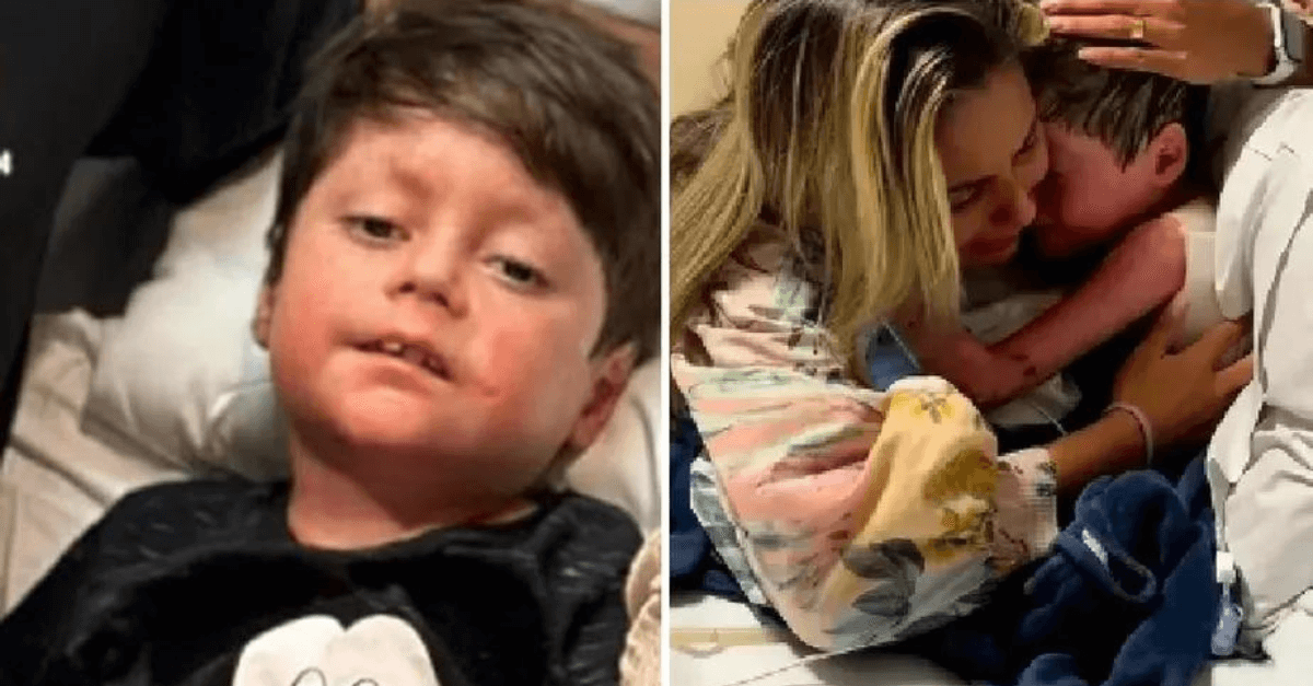 Epidermólise bolhosa: a doença rara de menino que acordou do coma chamando pela mãe