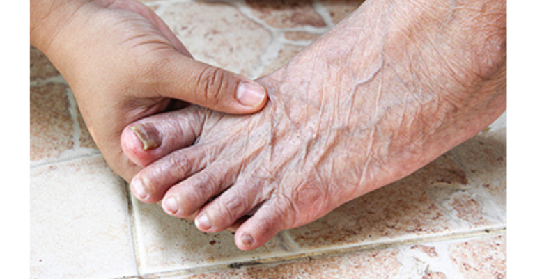 As doenças mais comuns nos pés de idosos