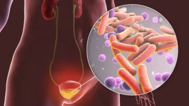 Bactérias na urina: por que aparecem e quais tratamentos estão disponíveis?