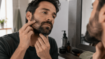 Escamas na barba: 6 cuidados com a pele que podem ajudar