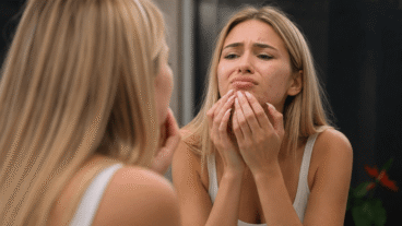 7 dicas para disfarçar uma espinha antes de um evento sem piorá-la